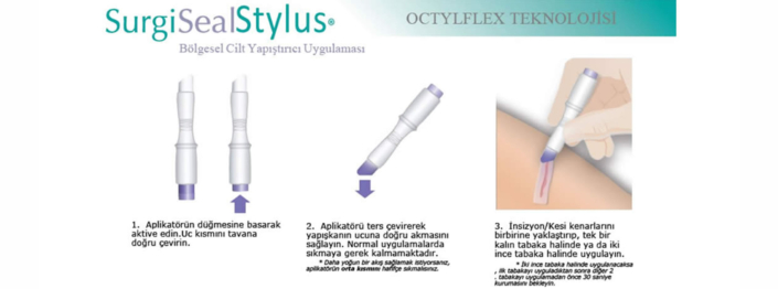 SurgiSeal Stylus